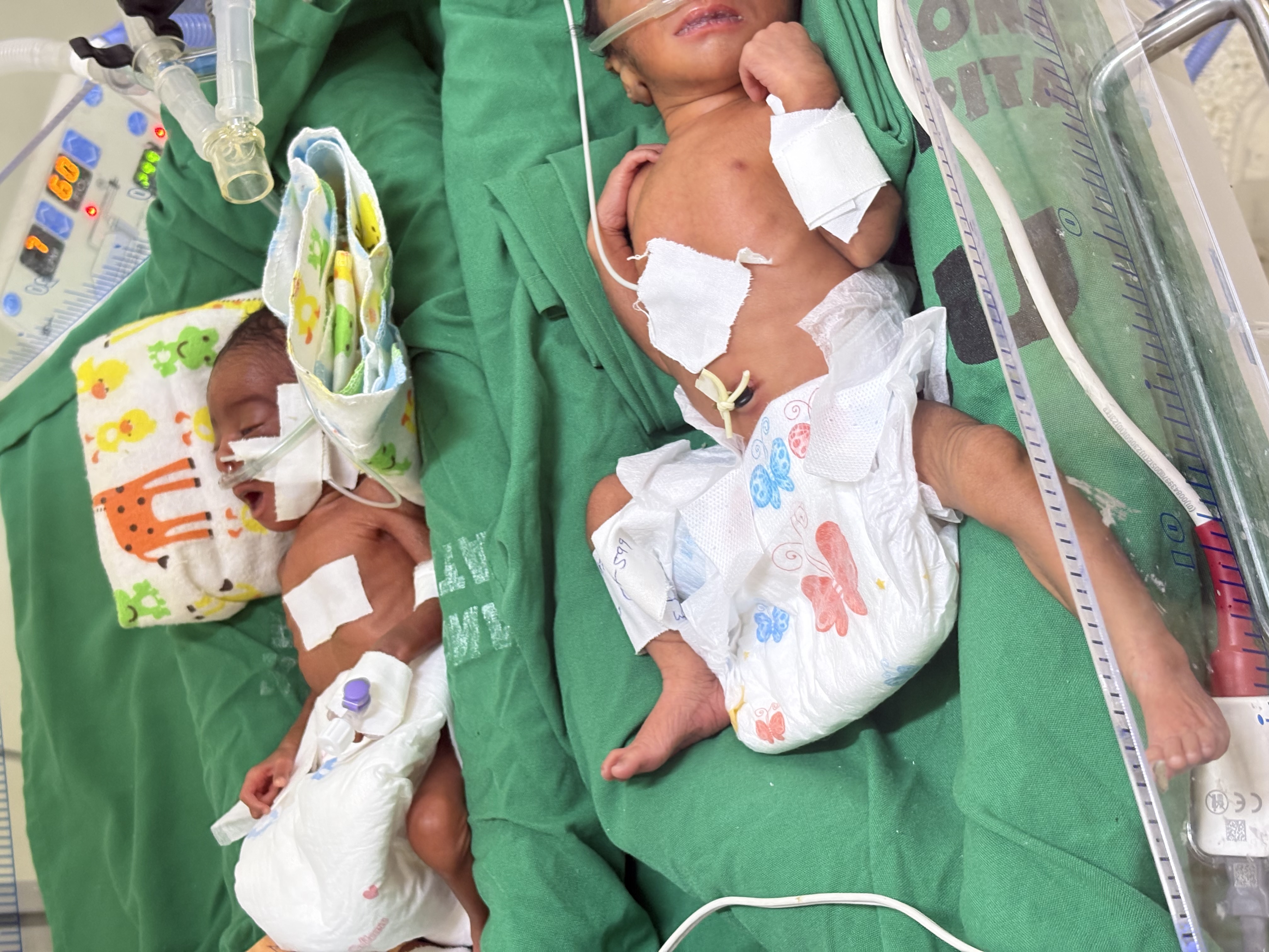 World Prematurity Day in Uganda: Awareness, Care, and Support for Preterm Babies (15 November)